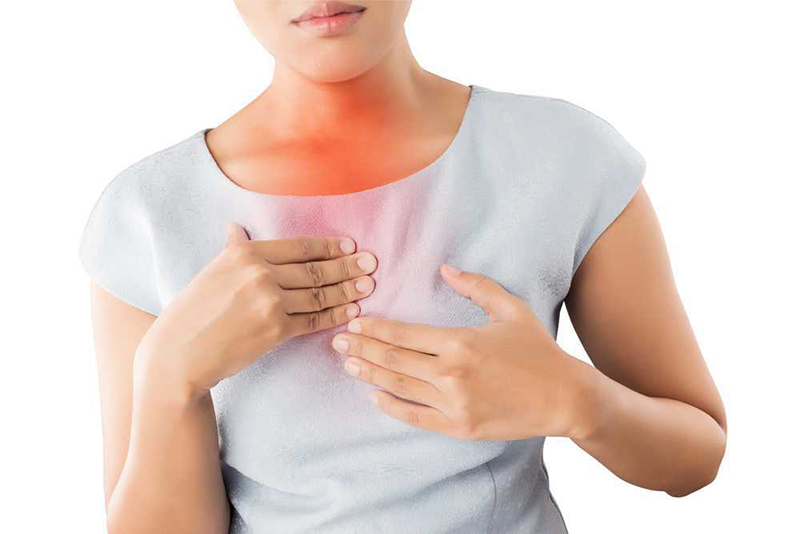 Doença do refluxo gastroesofágico (DRGE)