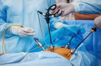 Cirurgia de Vesícula: procedimento e recuperação